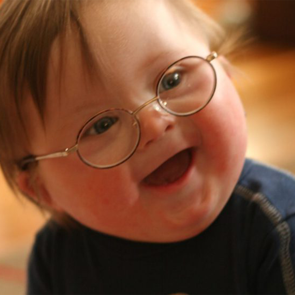 تصویر اصلی مقاله ی " سندروم چیست  و انواع روانشناسی و ژنتیکی آن "